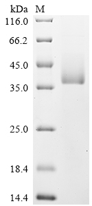 SDS-PAGE