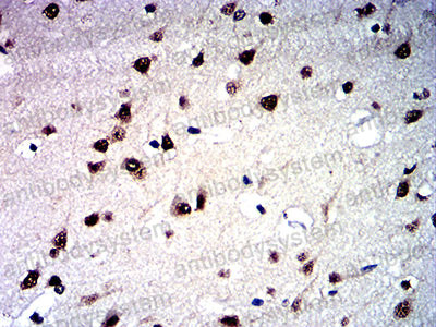 Валидация AntibodySystem RHG58202 (3004)