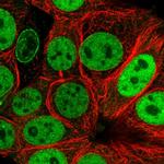 Валидация AssayVector ARM2169(3530)