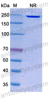 Валидация SDS-PAGE - AntibodySystem DHH02239