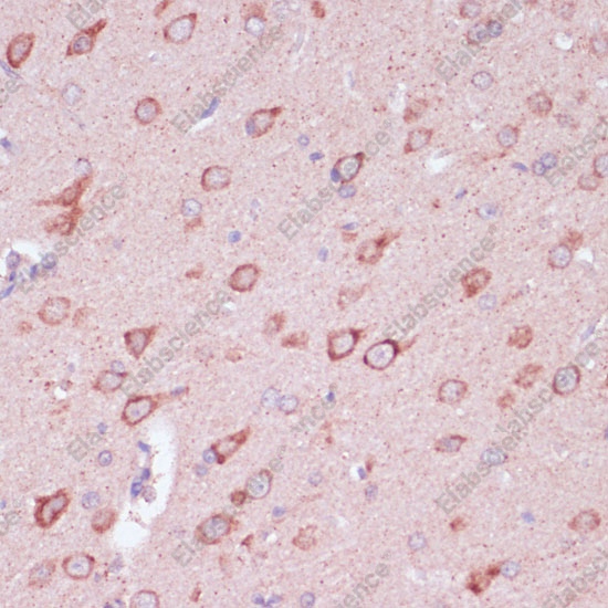 Иммуногистохимия, TOLLIP, ткань мозга крысы