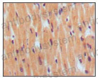Валидация AntibodySystem RHD19202