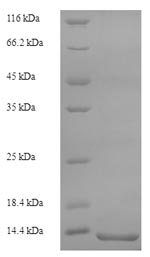 SDS-PAGE