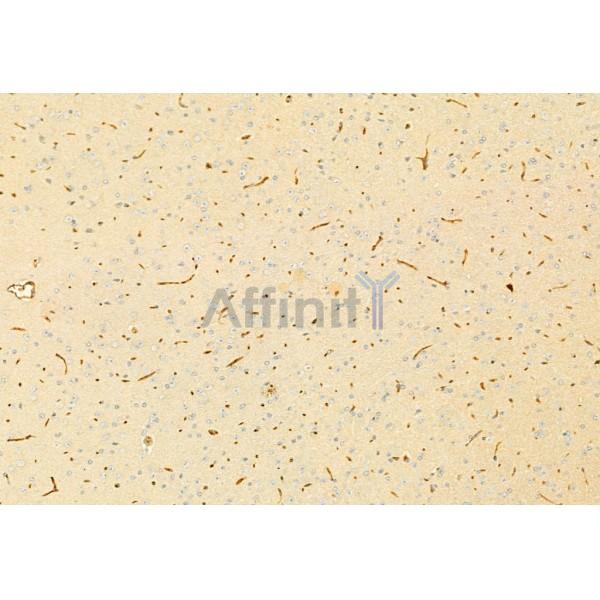 Валидация Affinity AF6265 - 3518