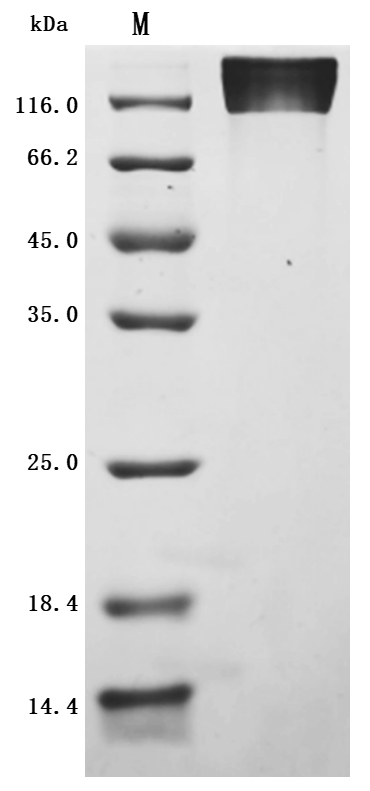 SDS-PAGE