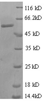 SDS-PAGE