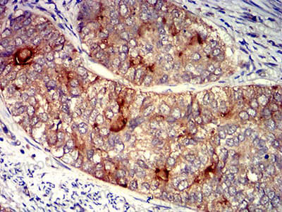 Валидация AntibodySystem RHD10404 (1335)