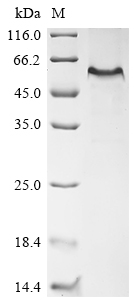 SDS-PAGE