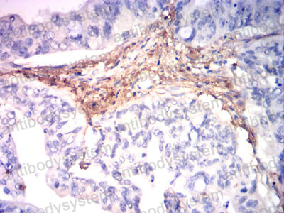 Валидация AntibodySystem RHF15801