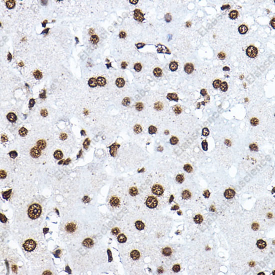 Иммуногистохимия, Histone H3, ткань печени человека