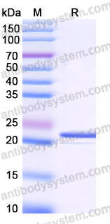 YHB91114, SDS-PAGE