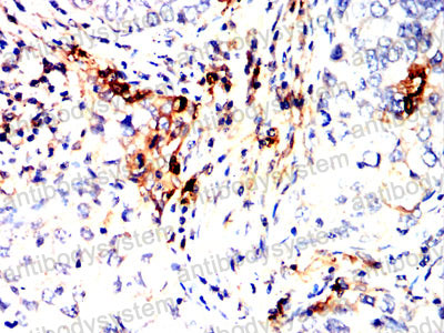 Валидация AntibodySystem RHH16101 (3195)