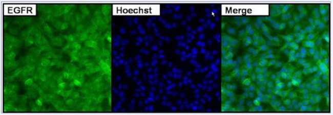 Валидация AssayVector ARM1109(303)