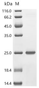 SDS-PAGE