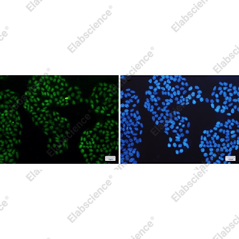 Иммунофлуоресценция, Glucocorticoid Receptor, клетки HeLa