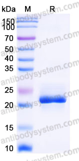 AHJ85303, SDS-PAGE