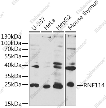 Вестерн-блоттинг, RNF114, различные клеточные линии