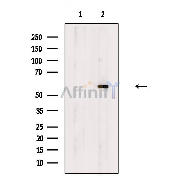Валидация Affinity DF8793 - 20826