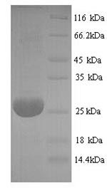 SDS-PAGE