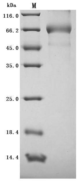 SDS-PAGE