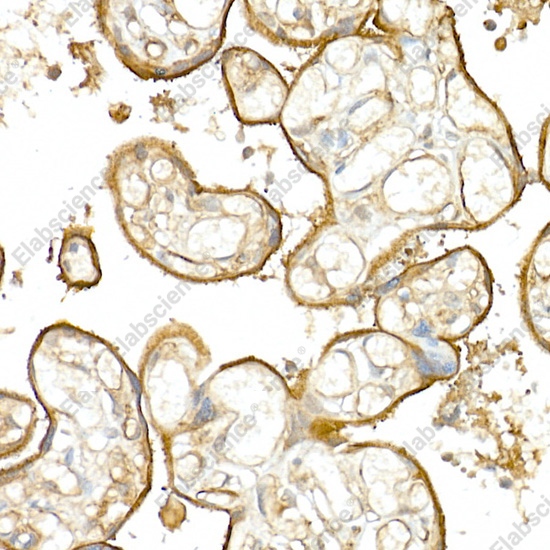 Иммуногистохимия, CD141/Thrombomodulin, ткань плаценты человека