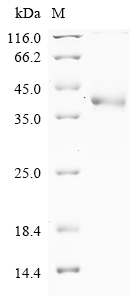 SDS-PAGE
