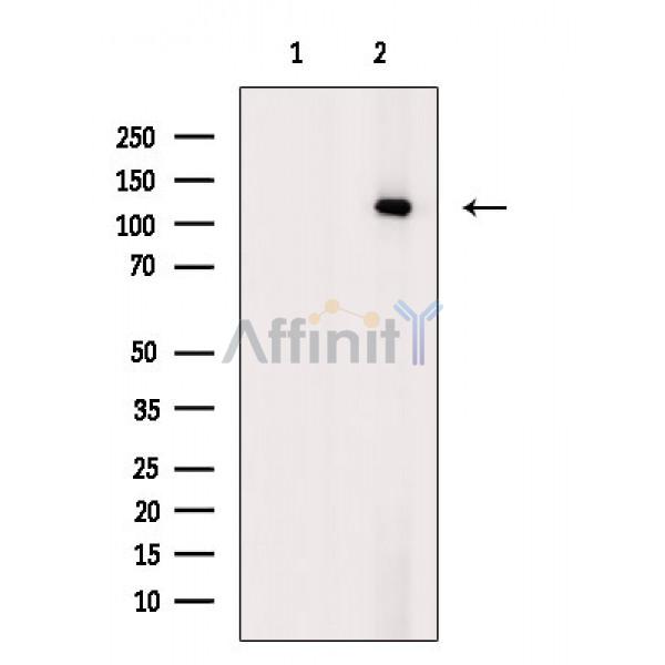 Валидация Affinity AF6877 - 4091