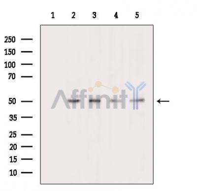 Валидация Affinity DF15546 - 11947