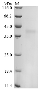 SDS-PAGE