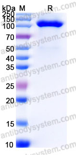 AHD38502, SDS-PAGE