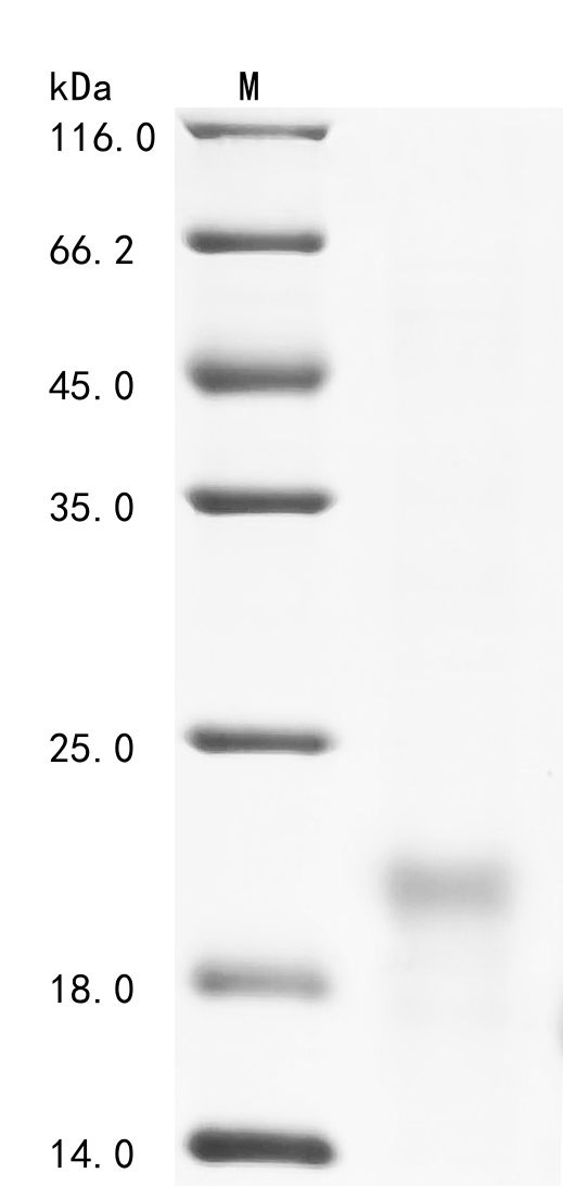 SDS-PAGE