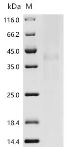 SDS-PAGE
