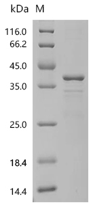 SDS-PAGE