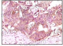 Валидация AntibodySystem RHC38202