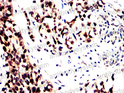 Валидация AntibodySystem RHN99501