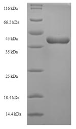 SDS-PAGE