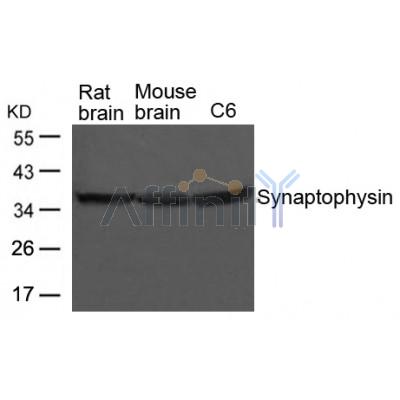 Валидация Affinity AF4095 - 2151