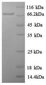 SDS-PAGE