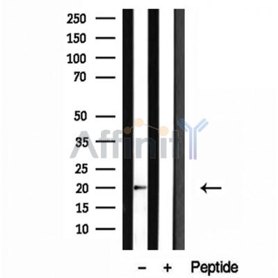 Валидация Affinity DF12095 - 6203