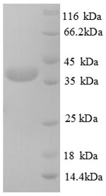 SDS-PAGE