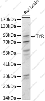 Вестерн-блоттинг, Tyrosinase, ткань мозга крысы