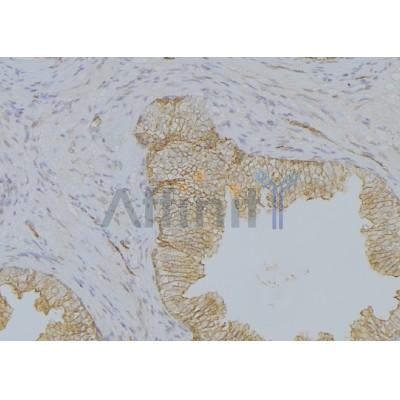 Валидация Affinity AF5106 - 2461