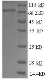 SDS-PAGE