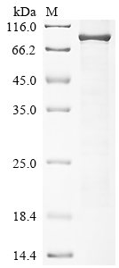 SDS-PAGE