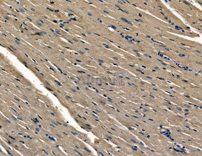 Валидация Affinity DF8754 - 20771