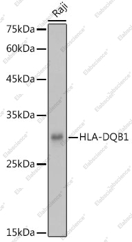 Вестерн-блоттинг, HLA-DQB1, клетки Raji