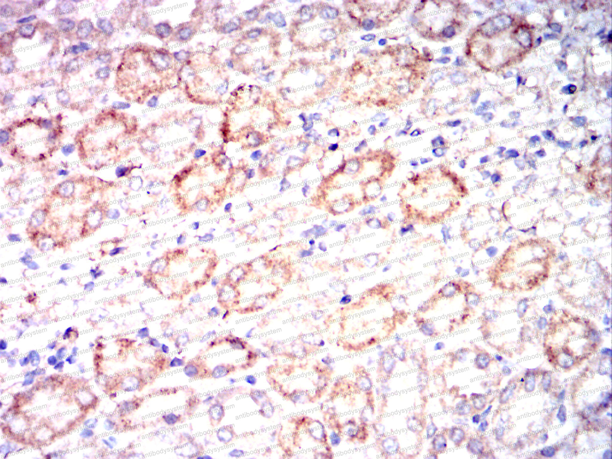 Валидация AntibodySystem RHC15806