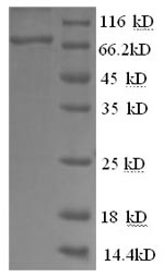 SDS-PAGE