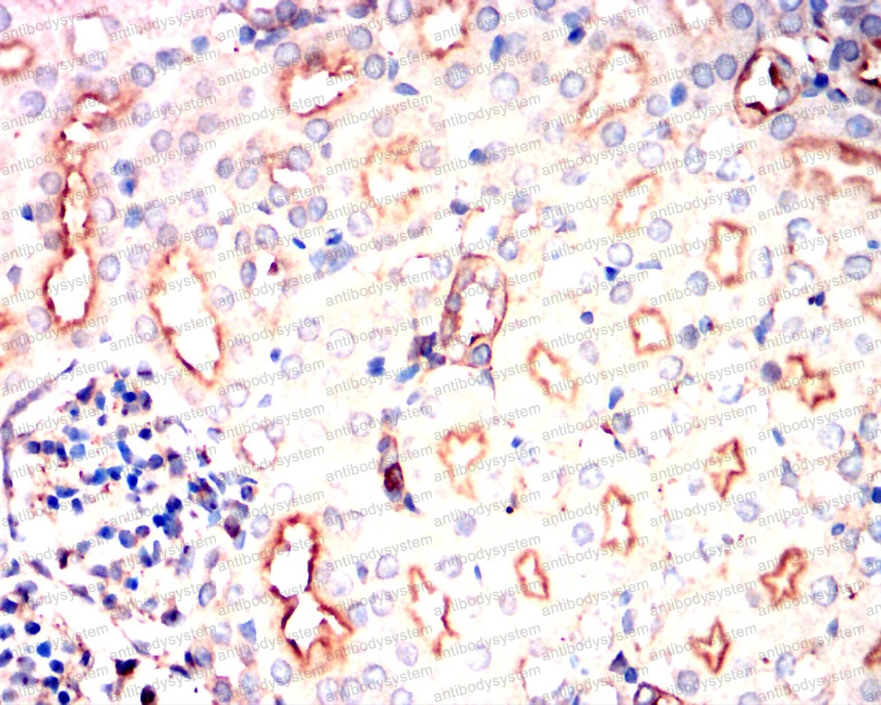 Валидация AntibodySystem RHE35201 (2100)