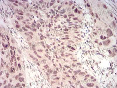 Валидация AntibodySystem RHG96902 (3129)